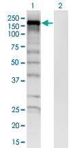 1 - SKIV2L monoclonal antibody (M05), clone 1E5 AT4671a