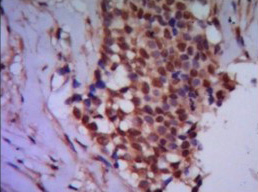 2 - Anti-PPP4C Antibody (2F11-D10-G4) ABV12074
