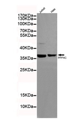 1 - Anti-PPP4C Antibody (2F11-D10-G4) ABV12074