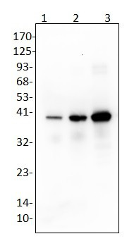 1 - Anti-Alanine Racemase Antibody ABV12111