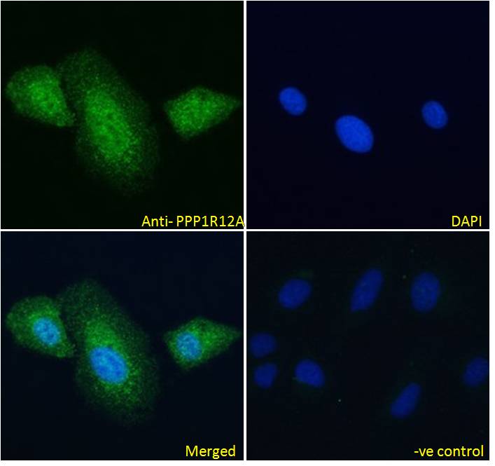 3 - Goat Anti-PPP1R12A Antibody AF4330a