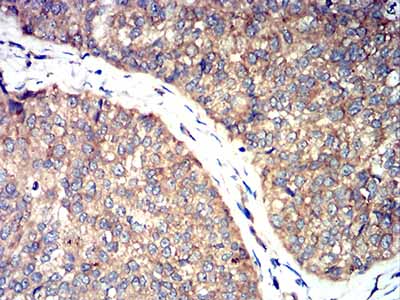 2 - ROP1 AO2512a