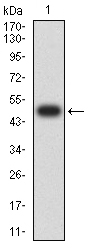 1 - ASF1B AO2519a