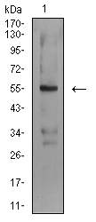1 - ASF1B AO2519a