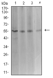 1 - ASF1B AO2520a