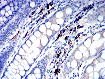 2 - IGLC2 AO2521a