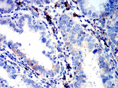 2 - IGLC2 AO2521a