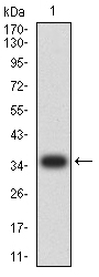 1 - IGLC2 AO2521a