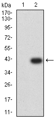 1 - IGLC2 AO2521a