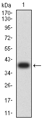 1 - TFAP2B AO2545a