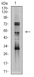1 - TFAP2B AO2545a