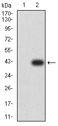1 - TFAP2B AO2546a