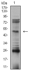 1 - TFAP2B AO2546a