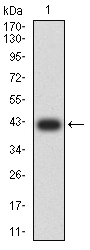 1 - IGHM AO2564a