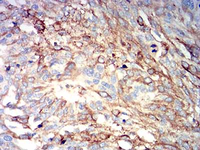 2 - IGHM AO2565a