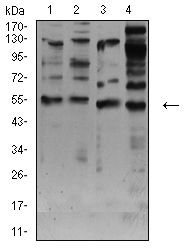 1 - CHRNA7 AO2586a
