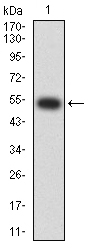 1 - CHRNA2 AO2597a