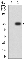 1 - CHRNA2 AO2597a