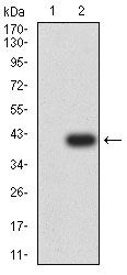 1 - P2RY4 AO2657a