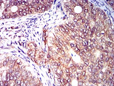 2 - CD158E1 AO2689a