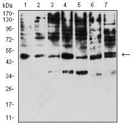 1 - KIR3DL1 AO2701a