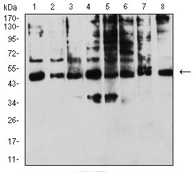 1 - KIR3DL1 AO2702a