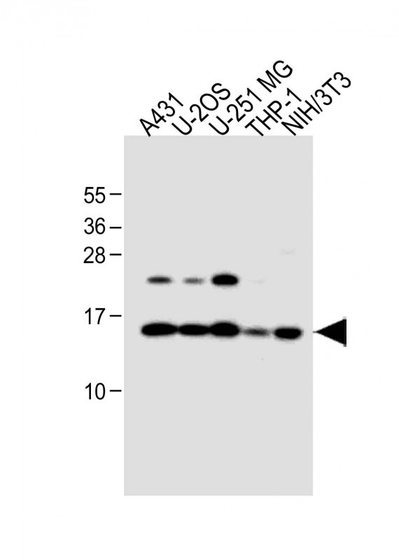 1 - RPL23 Antibody (Center) AP12578c