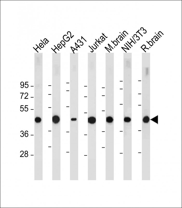 1 - TUFM Antibody (N-term) AW5218