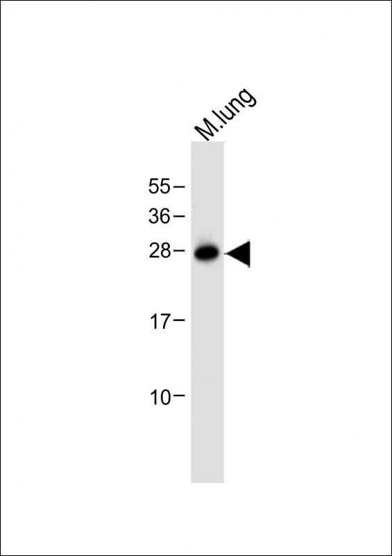 1 - Mouse Trem2 Antibody (N-term) AP19275a