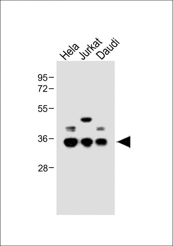 1 - BCKDHB Antibody (N-term) AP10672a