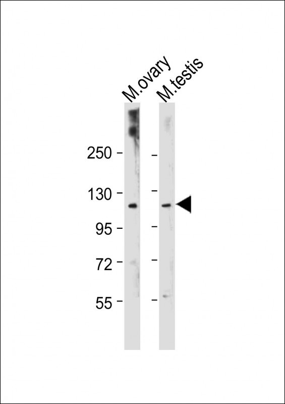 1 - Mouse Lats2 Antibody(C-term) AP19422b