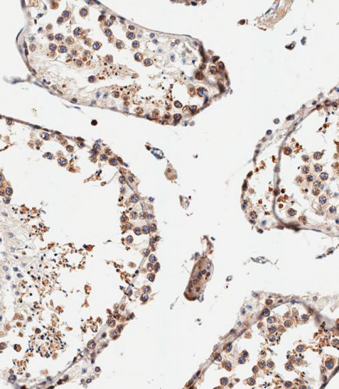 59 - IFITM5 Antibody (Center) AP11058c