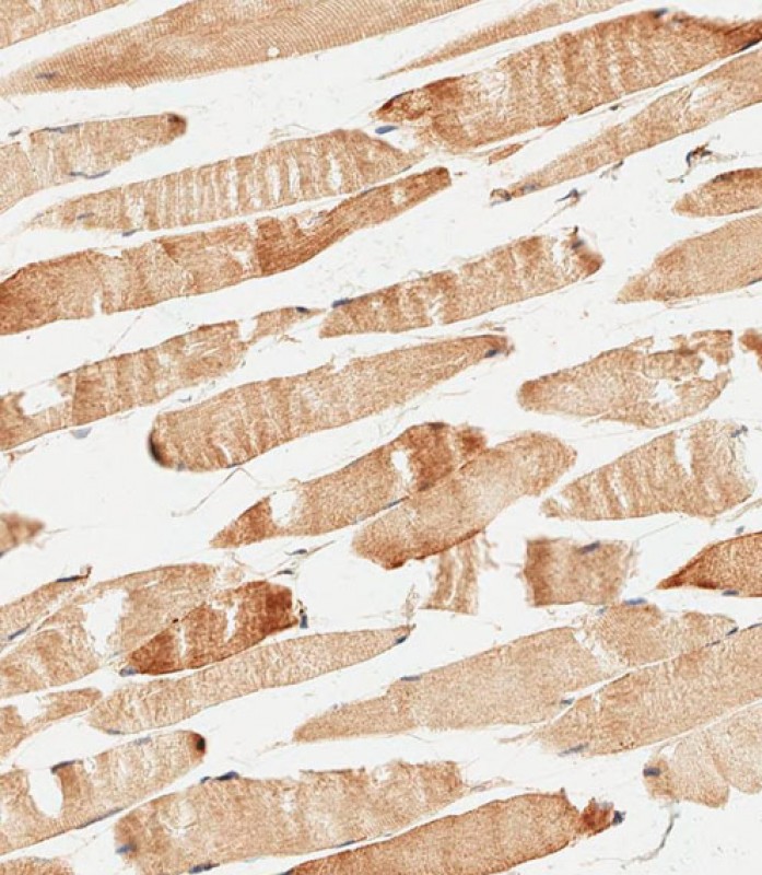 59 - KERA Antibody (C-term) AP12617b