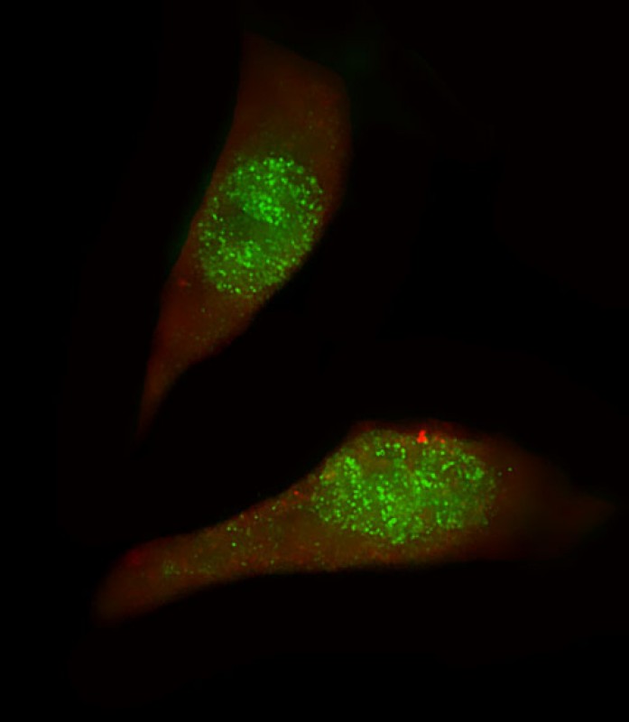 3 - USP27X Antibody (N-term) AP16881a