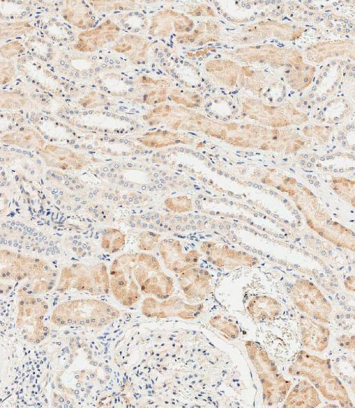 59 - LZIC Antibody (Center) AP17735c