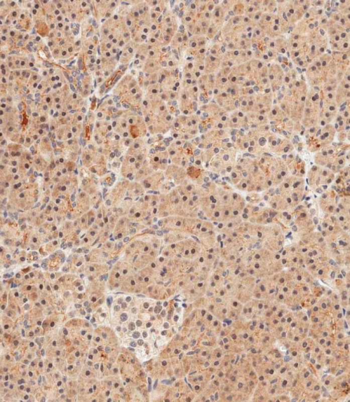 59 - UBE4B Antibody (N-term) AP2111a