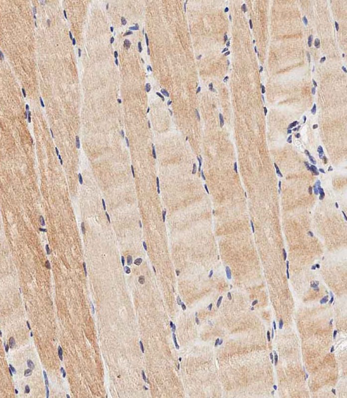 59 - ASAM Antibody (Center) AP13037c