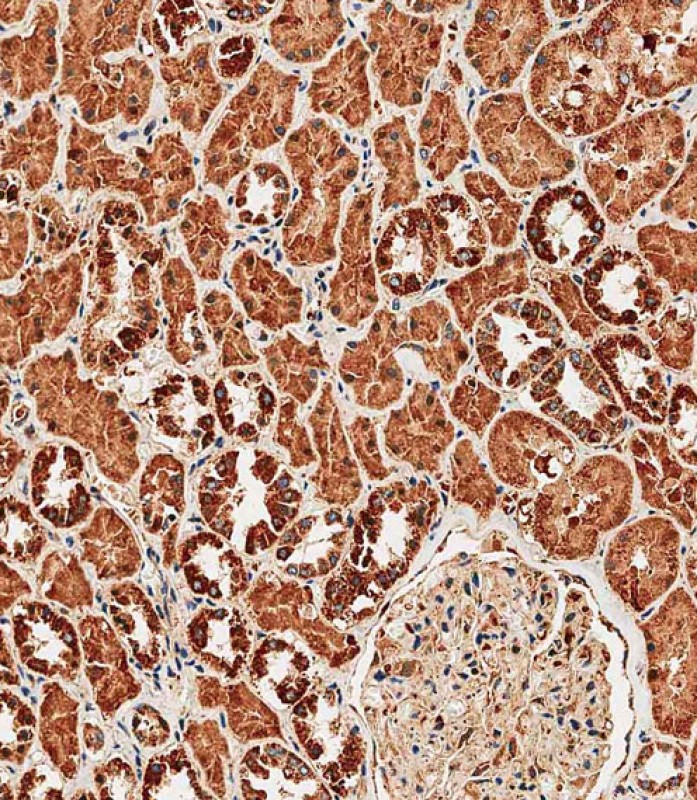 59 - TRPV1 Antibody (N-term) AP13988a