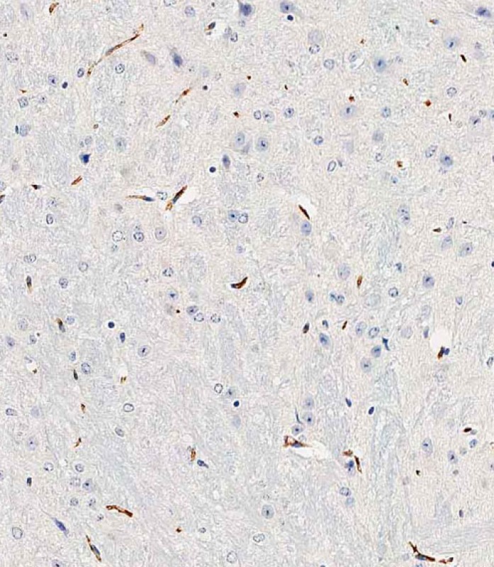 59 - Mouse Trem2 Antibody (N-term) AP19275a