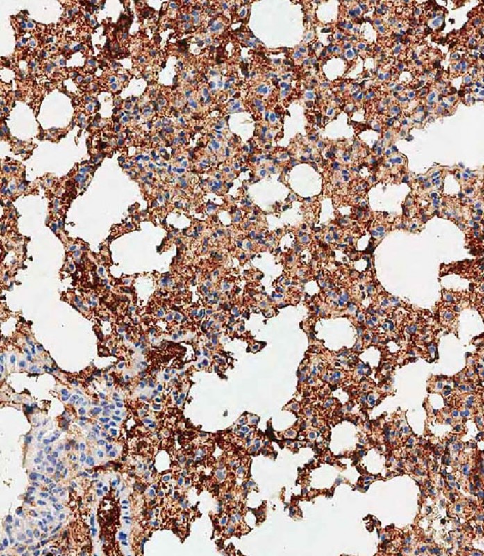 59 - Mouse Trem2 Antibody (N-term) AP19275a