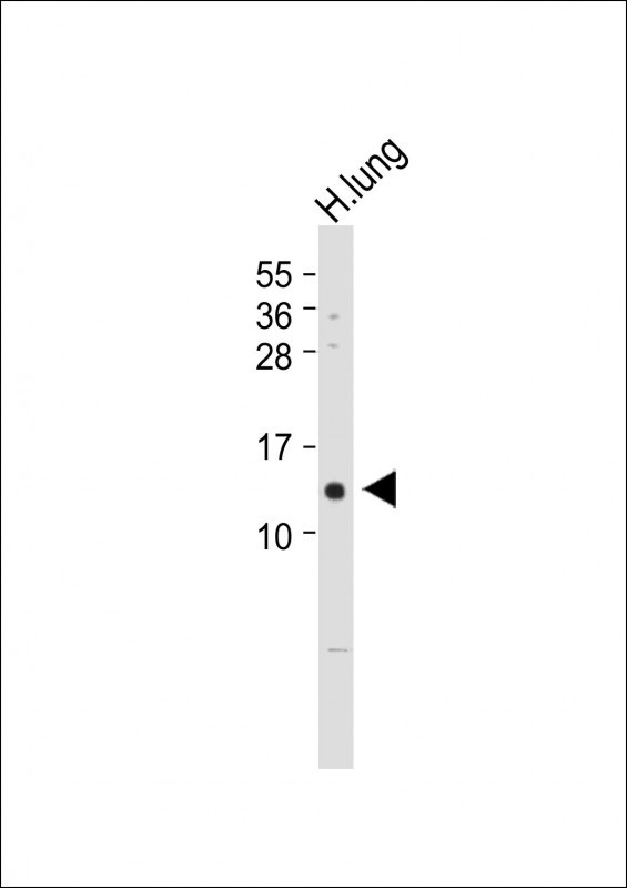 1 - VKORC1 Antibody (N-term) AP5859A