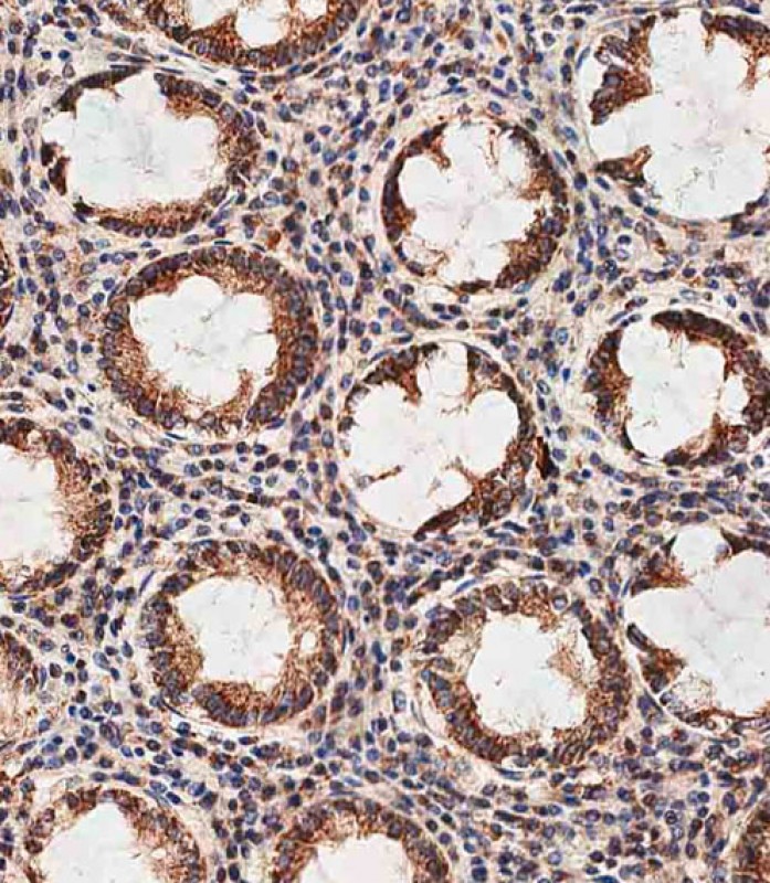 59 - PHB2 Antibody (Y248) AP7270e