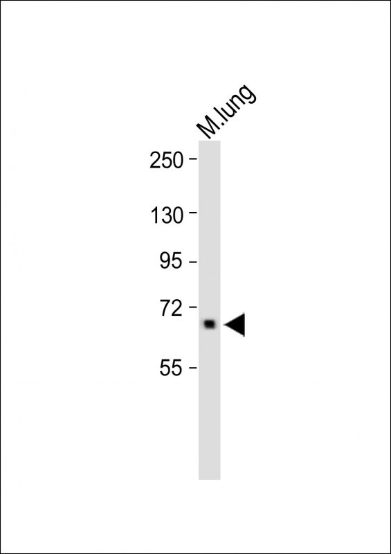 1 - ALOX12 Antibody (C-term) AP8877B