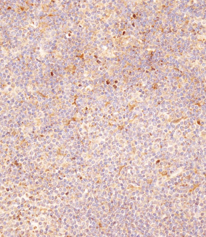 59 - FCGR1B Antibody (C-term) AP9197B