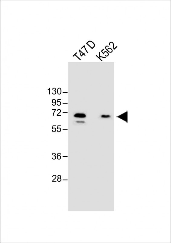 1 - YTHD3 Antibody (Center) AP9985A