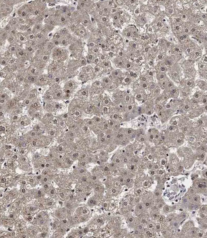 14 - CCNY Antibody (Center) AP10135C