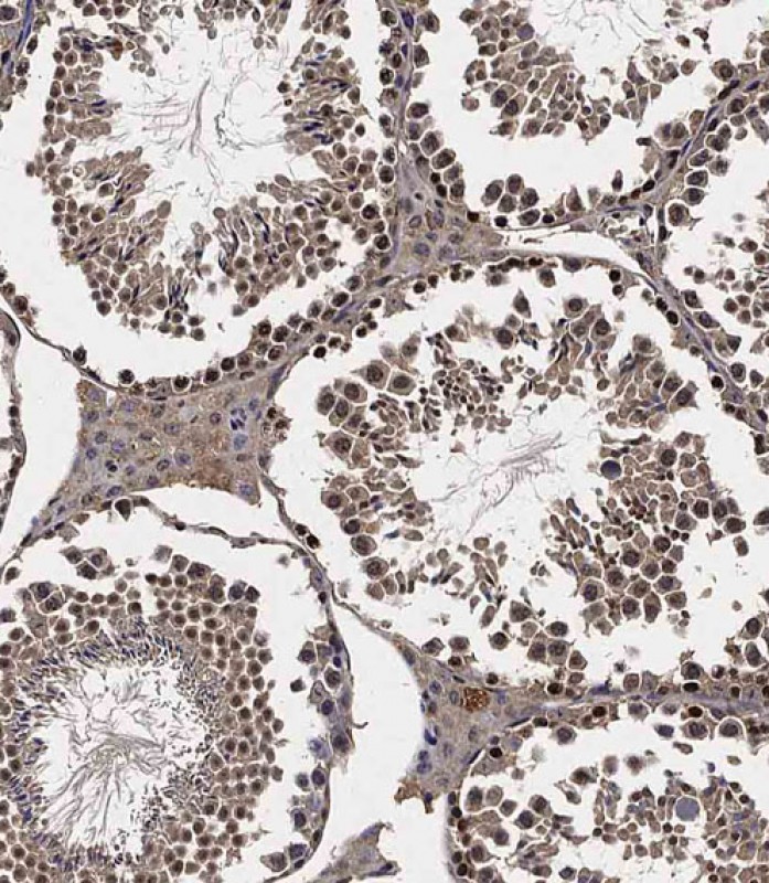 14 - Mouse Lats2 Antibody(C-term) AP19422b