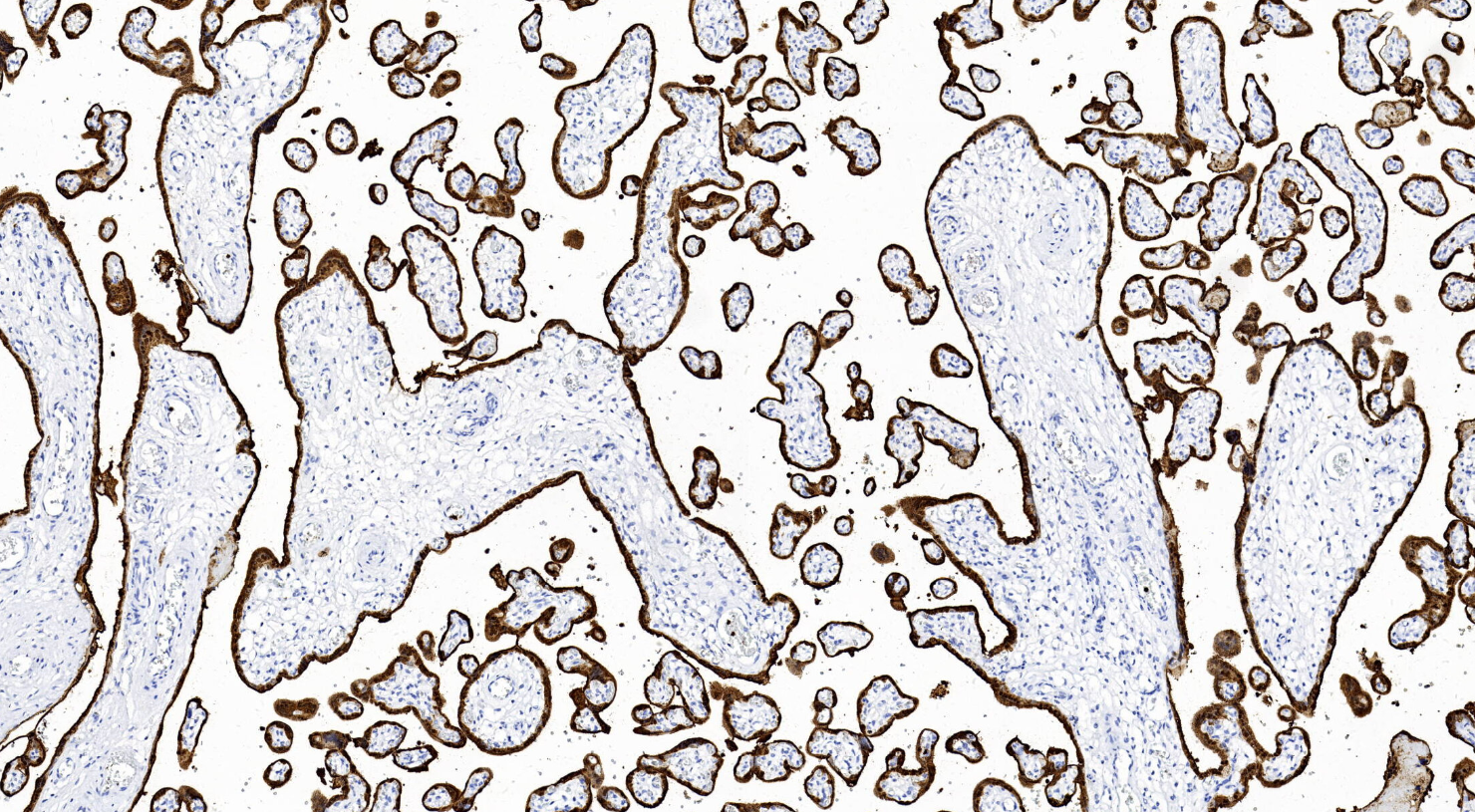 14 - S100P Antibody AD80113