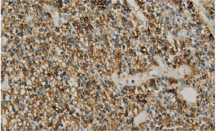 14 - PTH AD80306