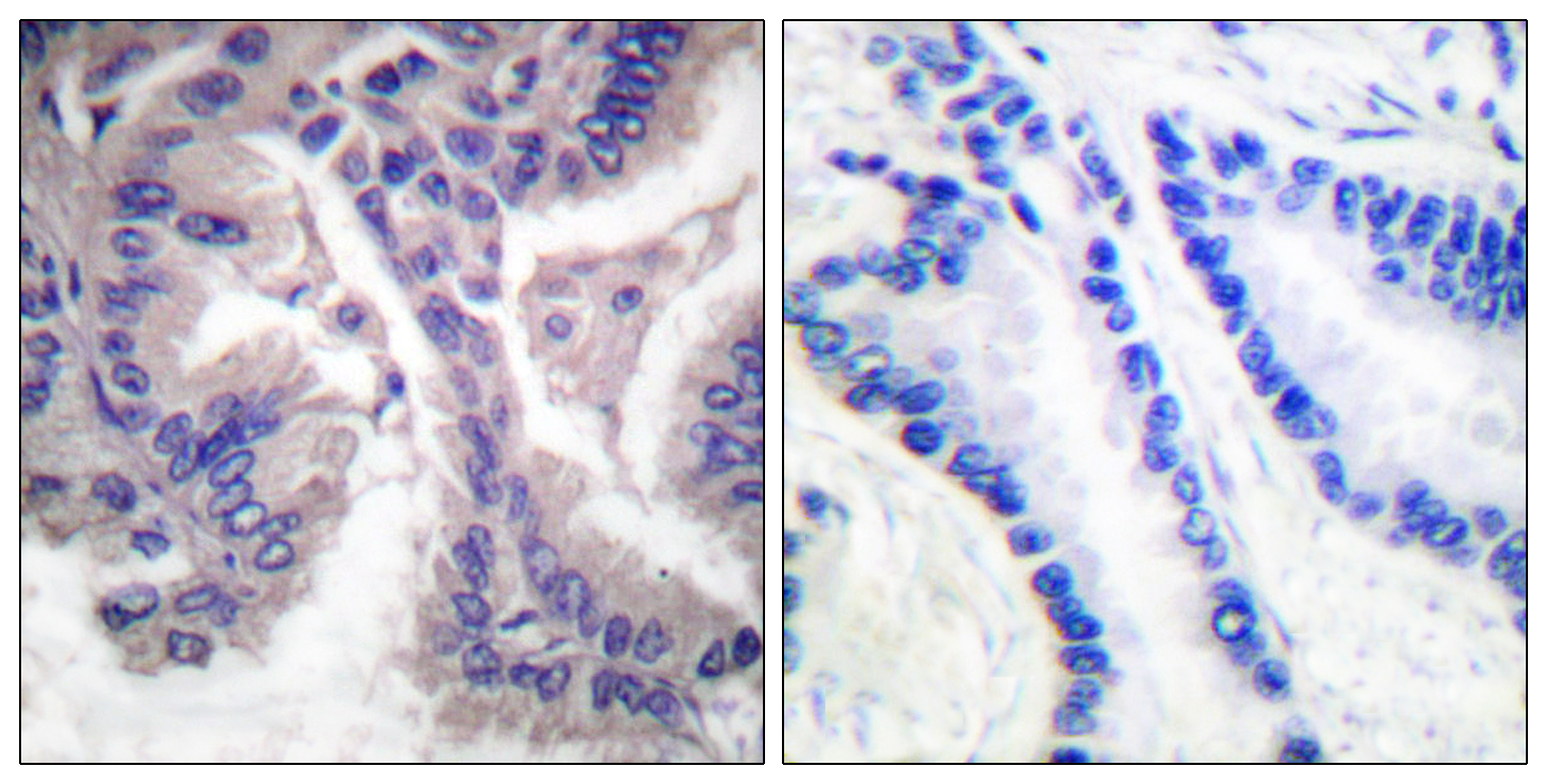 14 - Cleaved-Caspase-6 p18 (D162) Polyclonal Antibody AP63082